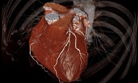 Cardiac Imaging in 2040