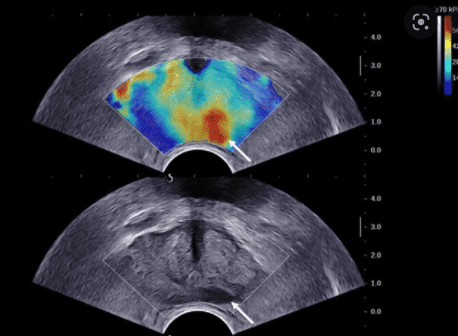 A Case for Multiparametric Ultrasound