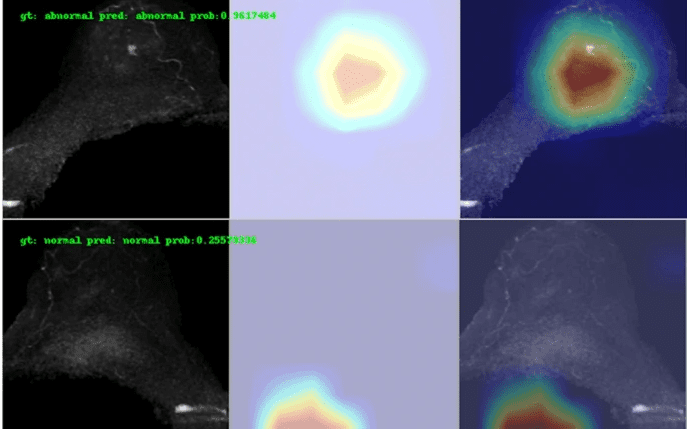 Autonomous & Ultrafast Breast MRI