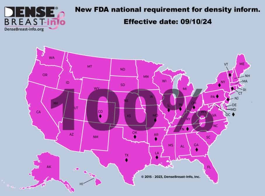 New FDA national requirement for density information