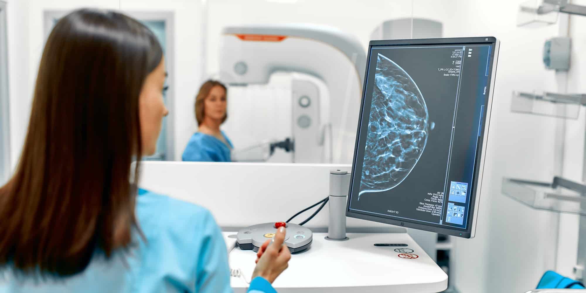 Mammography AI’s Leap Forward